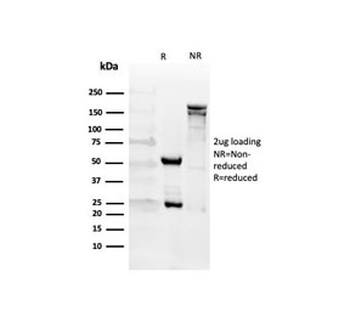 CD27 Antibody