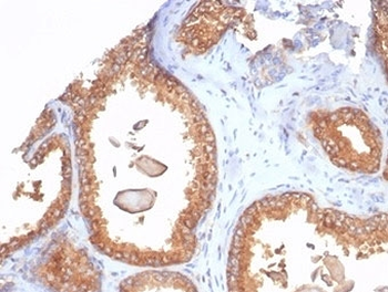 Recombinant Beta-2 Microglobulin Antibody
