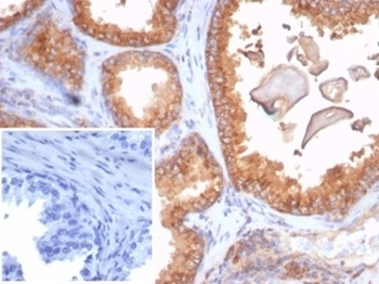 Recombinant Beta-2 Microglobulin Antibody