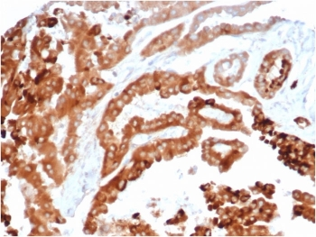 HAVCR2 Antibody / TIM-3