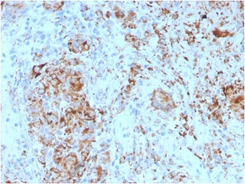 HAVCR2 Antibody / TIM-3