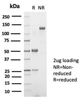 Recombinant TSH beta Antibody / TSHB
