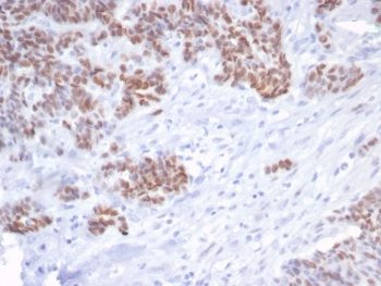 Recombinant TP53 Antibody / p53