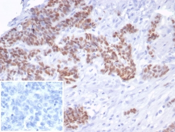Recombinant TP53 Antibody / p53