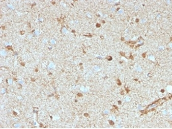 S100B Antibody