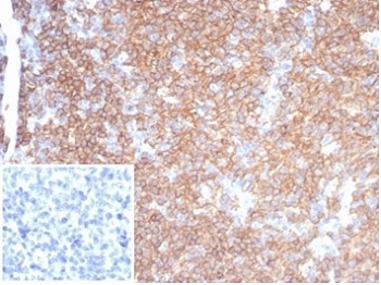 Recombinant CD45RA Antibody (Leukocyte marker)