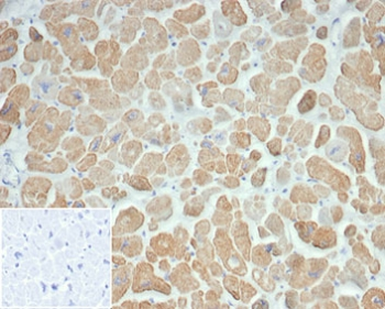 Recombinant ACTN2 Antibody / Alpha Actinin 2 / Sarcomeric Alpha Actinin