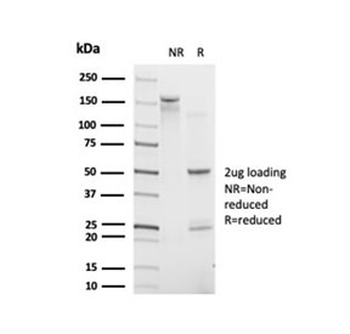 CHRAC17 Antibody / POLE3