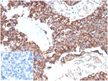TREM2 Antibody