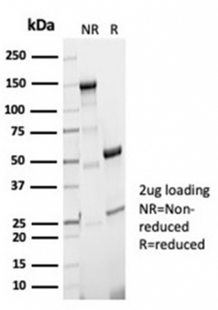 Recombinant Aciculin Antibody / Phosphoglucomutase 5 / PGM5