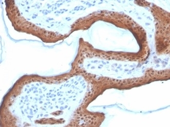 SERPINB5 Antibody / MASPIN