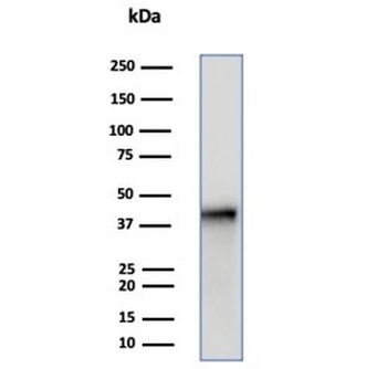 SERPINB5 Antibody / MASPIN