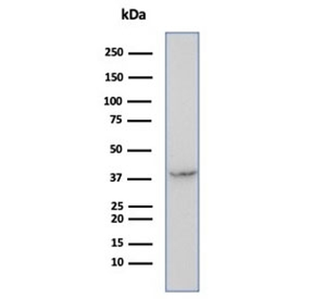SERPINB5 Antibody / MASPIN