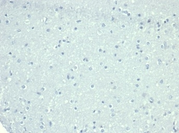 CD10 Antibody / Neprilysin
