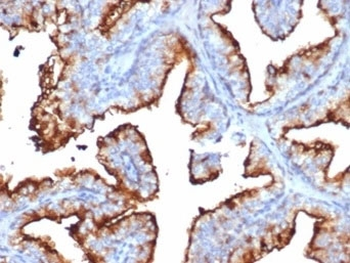 CD10 Antibody / Neprilysin