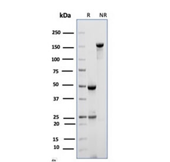 CD10 Antibody / Neprilysin