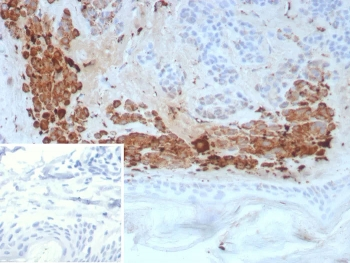 KLK4 Antibody / Kallikrein 4