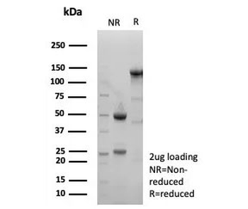 XCT Antibody / SLC7A11