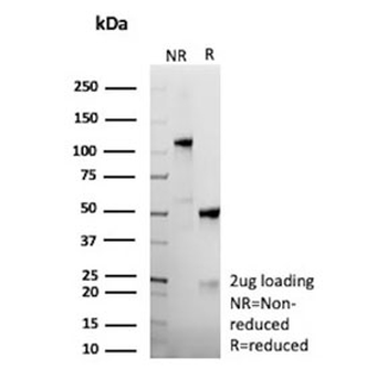 Recombinant Anaplastic Lymphoma Kinase Antibody / ALK