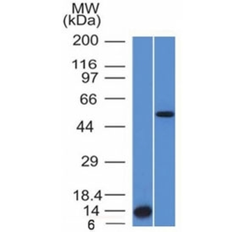 ALK Antibody / Anaplastic Lymphoma Kinase