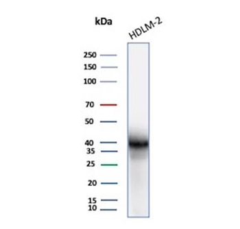 PD-L1 Antibody / B7-H1 / CD274