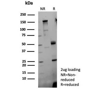 Fibroblast Growth Factor 23 Antibody / FGF-23