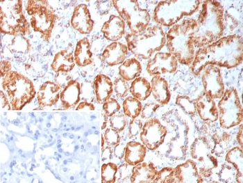 Fibroblast Growth Factor 23 Antibody / FGF-23