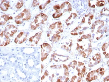 Fibroblast Growth Factor 23 Antibody / FGF-23