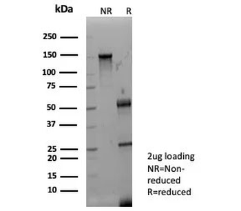 Fibroblast Growth Factor 23 Antibody / FGF-23