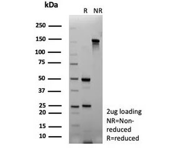 FGF23 Antibody / Fibroblast Growth Factor 23