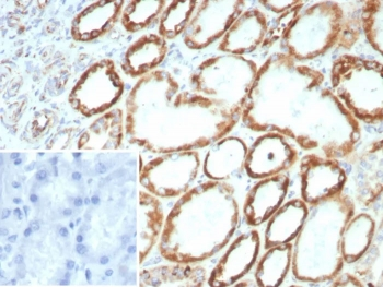 FGF23 Antibody / Fibroblast Growth Factor 23