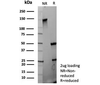 FGF23 Antibody / Fibroblast Growth Factor 23
