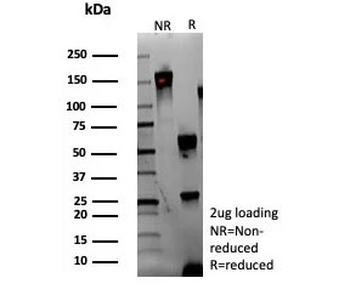 Adipophilin Antibody / Perilipin 2 / ADRP / PLIN2