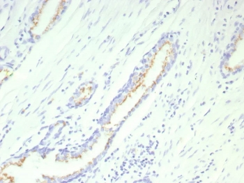 Recombinant SLC45A3 Antibody / Prostein