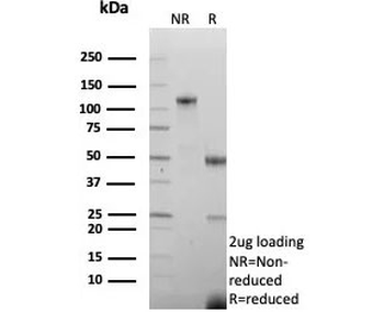 Recombinant SLC45A3 Antibody / Prostein