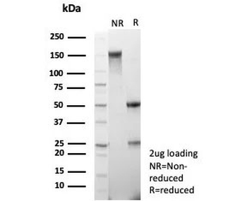 MRP8 Antibody / ABCC11