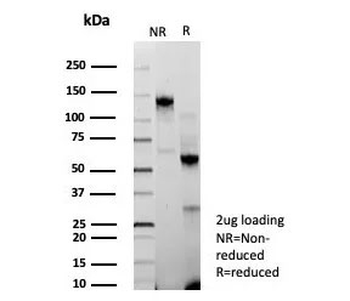 BAP1 Antibody / BRCA1-Associated Protein 1