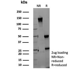 ZNF804A Antibody / Zinc finger protein 804A