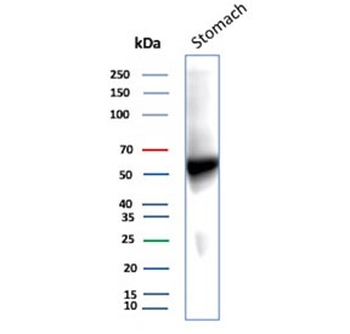 CA9 Antibody / Carbonic Anhydrase IX