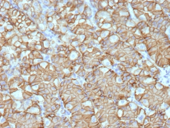 CA9 Antibody / Carbonic Anhydrase IX