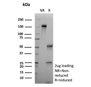CA9 Antibody / Carbonic Anhydrase IX