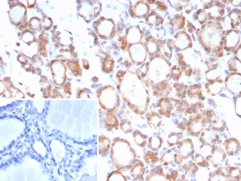 TrkB Antibody / NTRK2