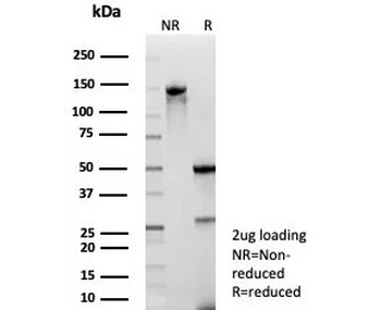 TrkB Antibody / NTRK2