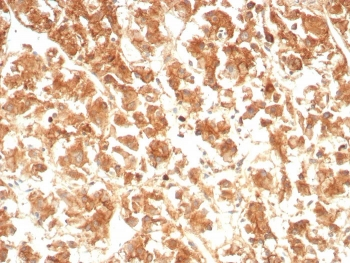 IL-18 Antibody