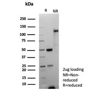 TDP43 Antibody / TARDBP / TAR DNA binding protein