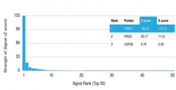 TNFR-Associated Factor 1 Antibody / TRAF1