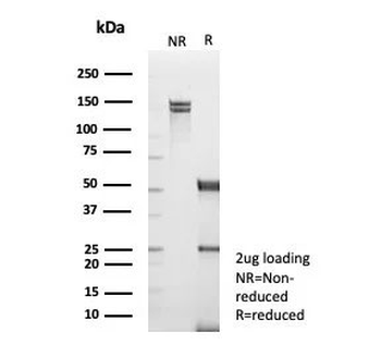 TNFR-Associated Factor 1 Antibody / TRAF1