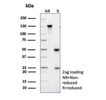 TRAF1 Antibody / TNFR-Associated Factor 1