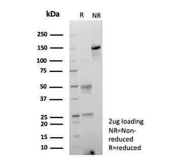 ARK1C1 Antibody / Aldo-keto Reductase Family 1 Member C1