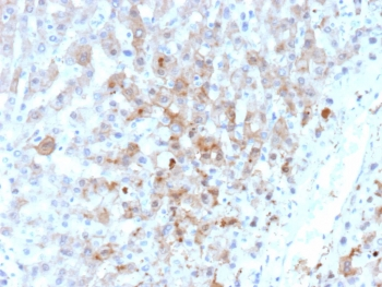 ARK1C1 Antibody / Aldo-keto Reductase Family 1 Member C1